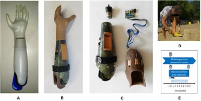 Longitudinal Case Study of Regression-Based Hand Prosthesis Control in Daily Life